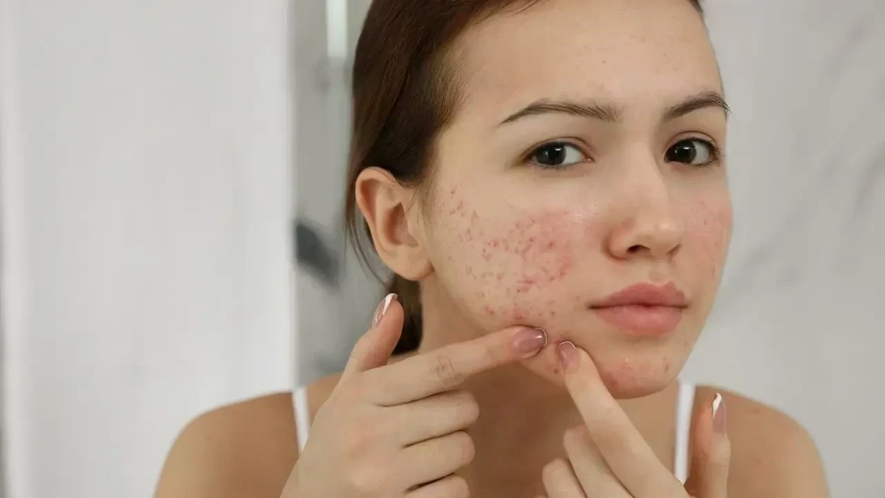 Skin Barrier Damage: Causes, Signs, and How to Repair It