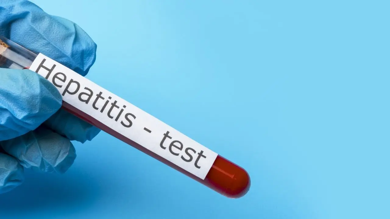 Surge in Hepatitis A Cases in Rural Manitoba